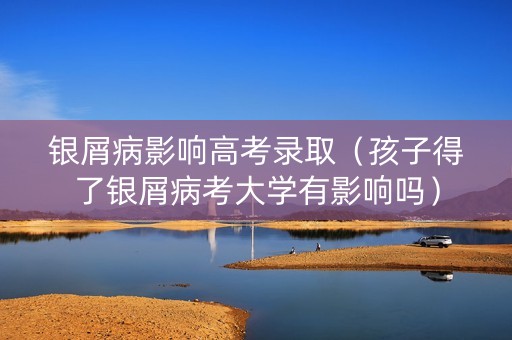 银屑病影响高考录取（孩子得了银屑病考大学有影响吗）